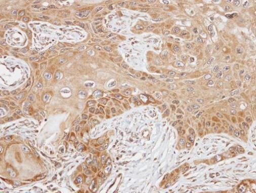 FAST Rabbit Polyclonal Antibody