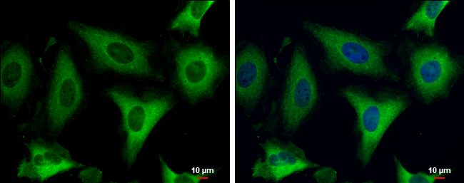 Fatty Acid Synthase antibody [N1N2], N-term