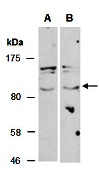 FBW7 (N) Antibody, Rabbit Polyclonal