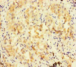 FBXL21 Antibody