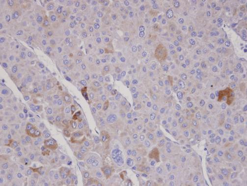 FBXO2 Rabbit Polyclonal Antibody