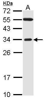 FBXO2 Rabbit Polyclonal Antibody
