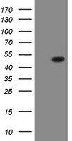 FBXO21 Antibody