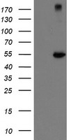 FBXO21 Antibody