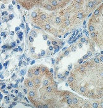 FBXO42 Rabbit Polyclonal Antibody