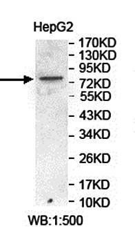 FBXO42 Rabbit Polyclonal Antibody