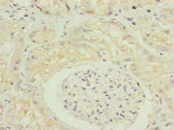 FBXO6 Antibody