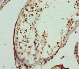 FBXO7 Antibody