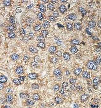 FBXW4 Rabbit Polyclonal Antibody