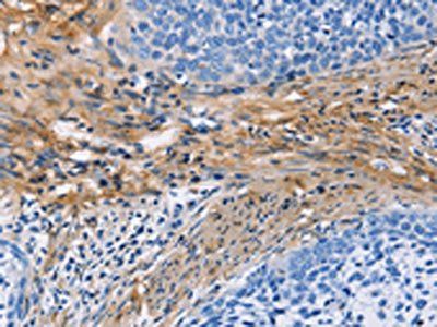 FCER2 Antibody