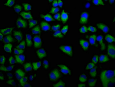 FCRL5 Antibody