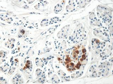 CYP24A1 Rabbit Polyclonal Antibody