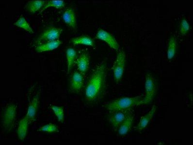 FERMT2 Antibody