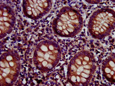 FERMT2 Antibody