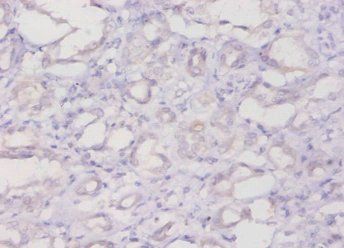 FTL Antibody