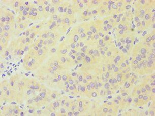 FES Antibody