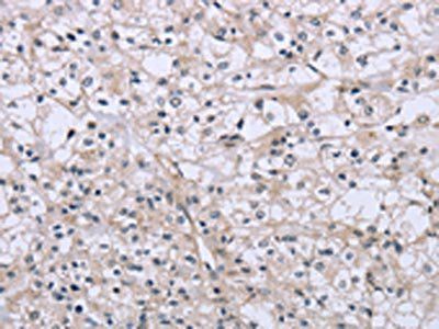 FES Antibody