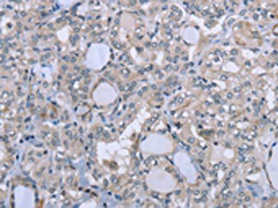 FES Antibody
