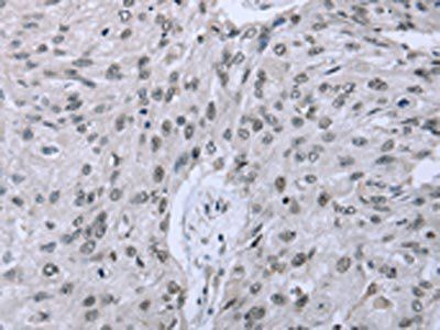 FES Antibody