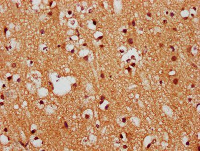 FEZF1 Antibody