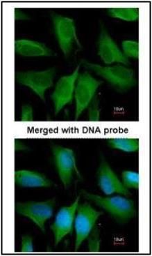 FGD4 Rabbit Polyclonal Antibody