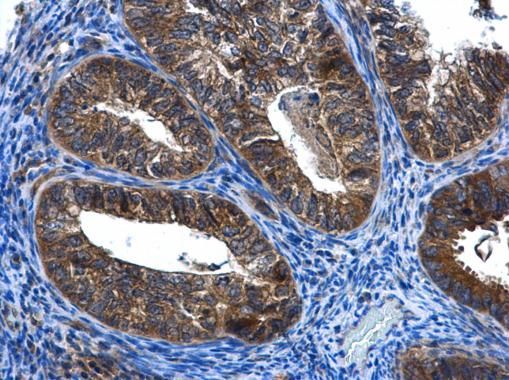 FGD4 Rabbit Polyclonal Antibody