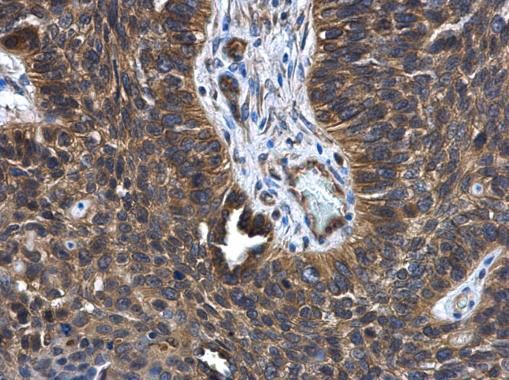 FGD4 Rabbit Polyclonal Antibody