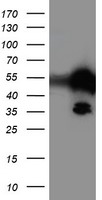 FGF21 Antibody