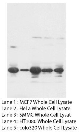 Fibroblast growth factor 8 FGF8 Rabbit Polyclonal Antibody