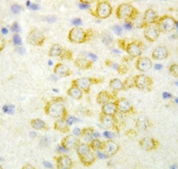 Fibroblast growth factor 9 FGF9 Rabbit Polyclonal Antibody