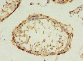 FGFBP2 Antibody