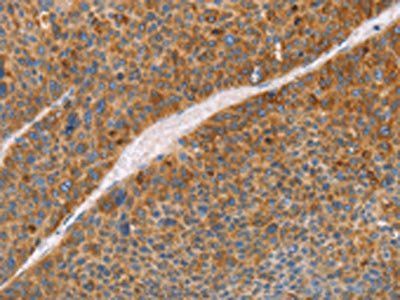FGL1 Antibody