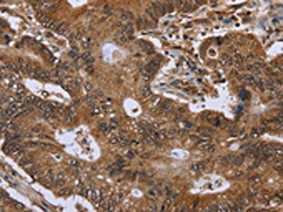 FHIT Antibody