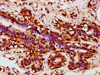 FHOD1 Antibody