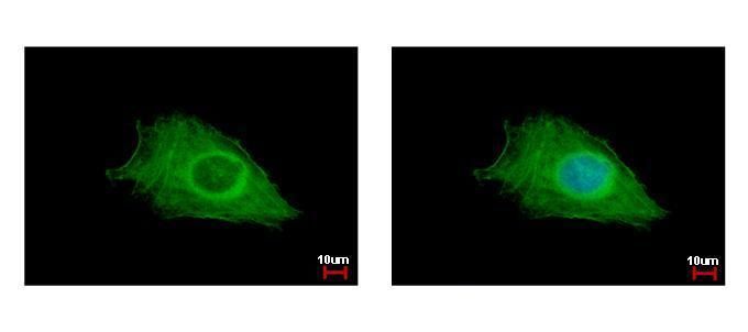 FIG4 phosphoinositide 5-phosphatase Antibody