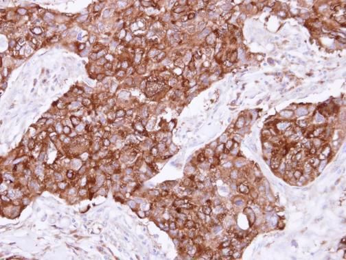 FIG4 phosphoinositide 5-phosphatase Antibody