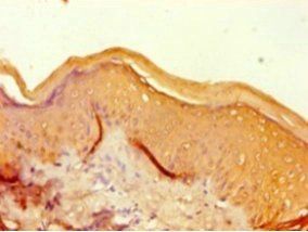FLG Antibody
