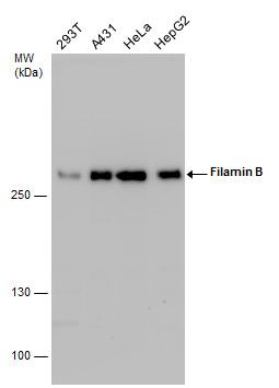 Filamin B antibody [N1], N-term