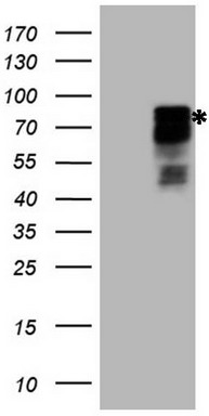 BFSP1 Antibody