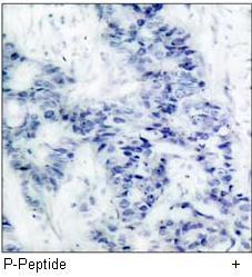 FKHR (Phospho-Ser256) Antibody