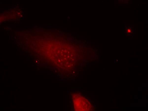 FKHR (Phospho-Ser319) Antibody