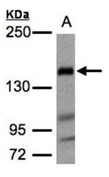 Flightless I Rabbit Polyclonal Antibody