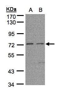 FLRT1 Rabbit Polyclonal Antibody