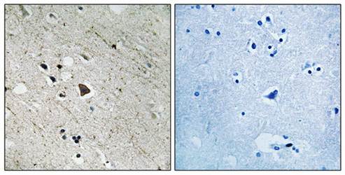 FLT3 (Phospho-Tyr969) Antibody