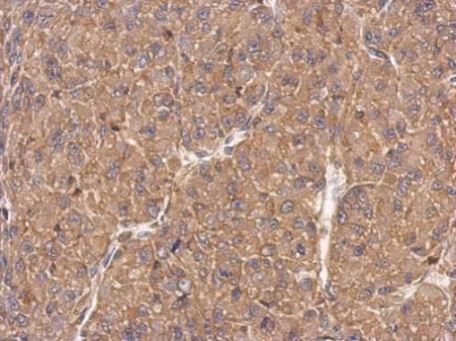 FMNL1 Rabbit Polyclonal Antibody