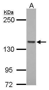 FMNL1 Rabbit Polyclonal Antibody
