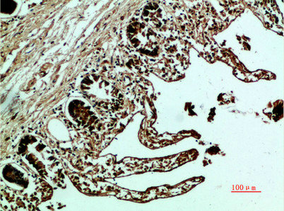 FN1 Antibody