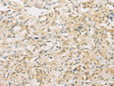 FNTA Antibody