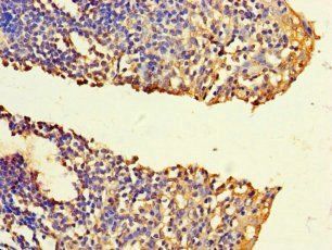 FNTB Antibody