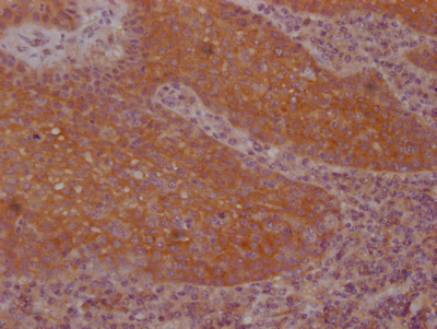 FNTB Antibody